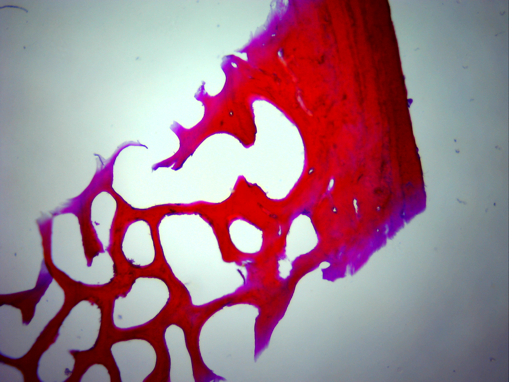 Tejido óseo esponjoso (40 aumentos)